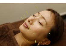 とまり木鍼灸整骨院 北青山院/落ち着いた空間での美容鍼です