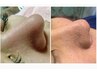 毛穴の黒ずみ詰まりザラザラ肌におススメ！！一度でスッキリ汚れを取り除く！