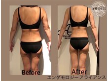 アムール 麻布十番(Amour)/エンダモロジーアライアンス