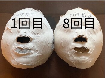 パール/石膏パックのビフォーアフター