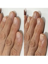 ギフト(GIFT)/自爪育成ネイルケア