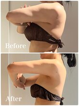 リッシュボーテ(RICHE BEAUTE)/【広尾/リンパマッサージ/痩身】