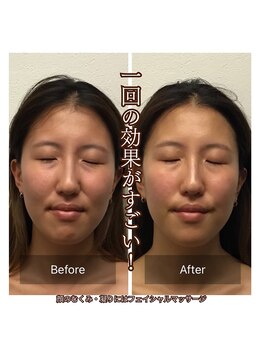 サロンドオフ 西梅田(salon de off)/フェイシャルマッサージの*