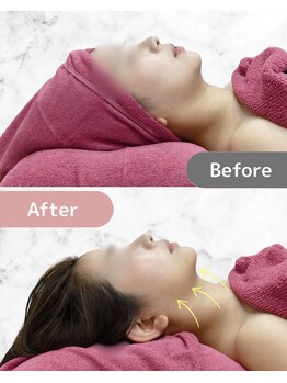 ミネット(minette)/レモンボトル*before→after