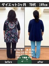 恵整骨院/70代ダイエット実績　痩身/整体