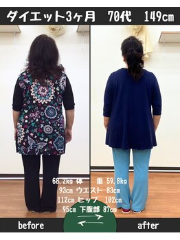 恵整骨院/70代ダイエット実績 痩身/整体