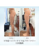 エスプレッソ(espresso,)/【下半身痩身】美尻もお任せ！