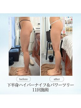 エスプレッソ(espresso,)/【下半身痩身】美尻もお任せ!