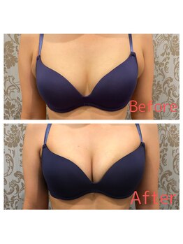 シャルム(CHARME)/バストアップも得意☆