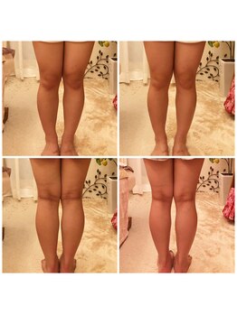 さくら整体院/深層リンパスリム /部分集中(脚)