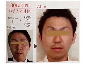 ソレイユ/バクテリウム(肌育菌)ピール