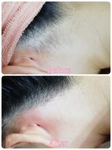 ベイジョ デ アンジョ(Beijo de anjo)/うなじシュガーリング