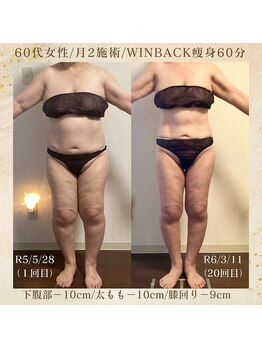 エソール(essor)/痩身月1でもこんなに変わる?!