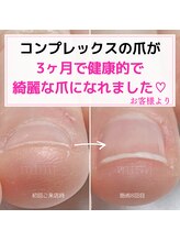 ミミ(mimi)/健康的で綺麗な爪に！