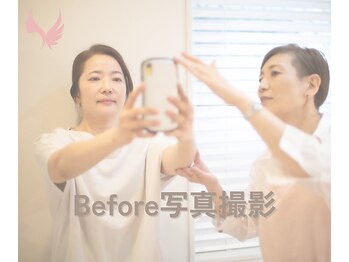 アンジュフェイス(Ange Face)/2. Before写真撮影