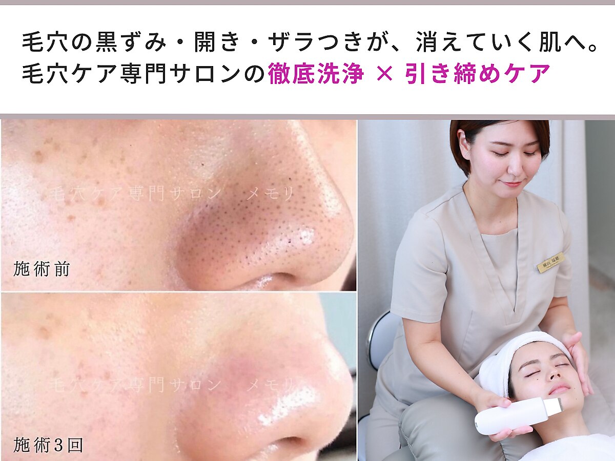 横浜市都筑区で毛穴洗浄・毛穴吸引が人気のエステサロン