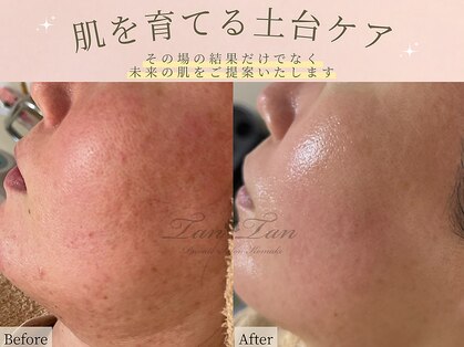 プライベートサロン タンタン(tantan)の写真