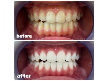 ホワイトベリー(White Berry)