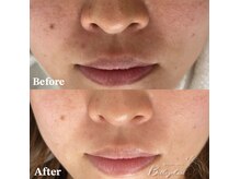 ベルアイラッシュ(Belleyelash)/【フェイシャルワックス】