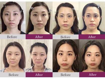 ビコツゼロ 青山(BIKOTSU ZERO)の写真