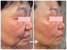 アブソリュートワン(absolute1)/NEW☆バクチ甦生プログラム