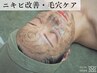 ■■2回目口コミ特典■■新規価格でもう一度！剥離なし/ありハーブピーリング