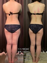 エステサロン ベリシモ(Bellissimo)/痩身/ビフォーアフター