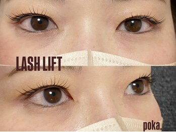 ポカ(poka.)/-立ち上げ+ロッド-