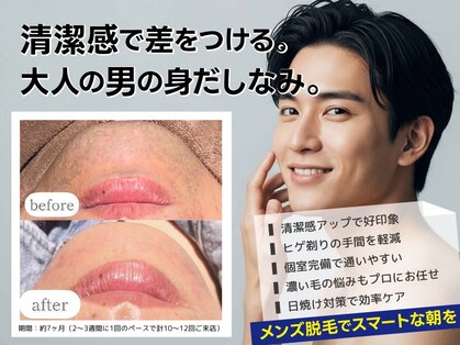 フォルチェ 春日(Folche)の写真