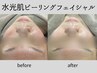 【毛穴・キメ】開き毛穴・ザラつきに／陶器のような滑らか水光肌60分¥16000⇒