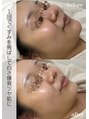 リアルナ(REALUNA)&nbsp;１回で美白 白玉肌！