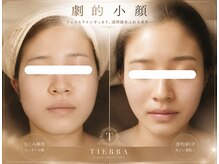 ティエラ(TIERRA)の雰囲気（回を重ねる事に効果を発揮！イタ気持ちいいがクセになる）