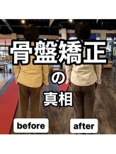 カワル整体 上通り院/【骨盤矯正の真相】