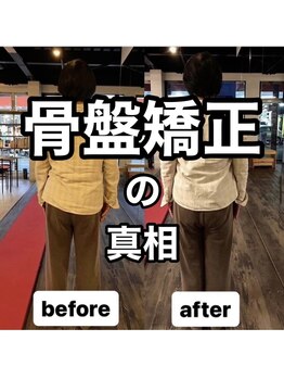 カワル整体 上通り院/【骨盤矯正の真相】