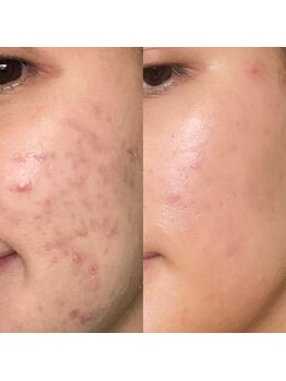 アイクイーン 亀戸(Eyequeen)/