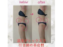ヨサパーク エトワール 聖蹟桜ヶ丘店(YOSAPARK)/before、after♪