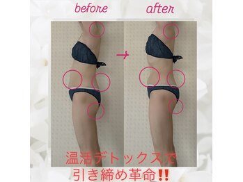 ヨサパーク エトワール 聖蹟桜ヶ丘店(YOSAPARK)/before、after♪