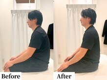 ソレア(Solea)/猫背・肩こり改善１回目