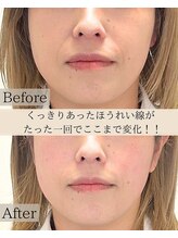 エテルニテ(eternite)/劇的変化！！