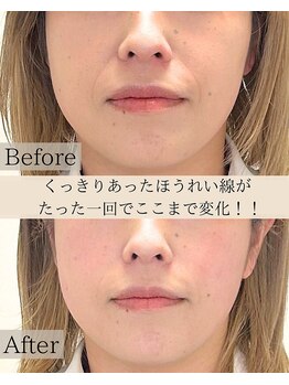 エテルニテ(eternite)/劇的変化！！