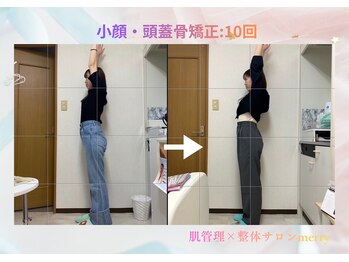 メリー 大和西大寺店(merry)/小顔・頭蓋骨矯正Before after★