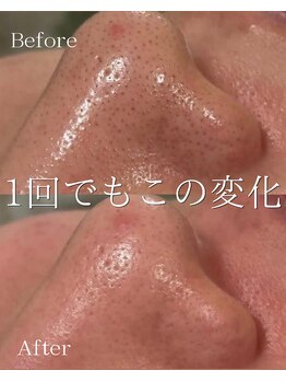 ココ 千里丘(Cocoh)/