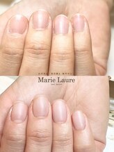 マリーロール 梅田店(Marie Laure)/自爪育成/深爪矯正/ネイルケア