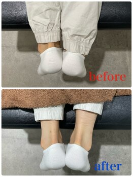 ナオル整体 新宿院(NAORU整体)/20代女性-骨盤矯正Before/After