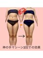 エピ(ep) 【綺麗に痩せる】をモットーに効果出ししていきます!
