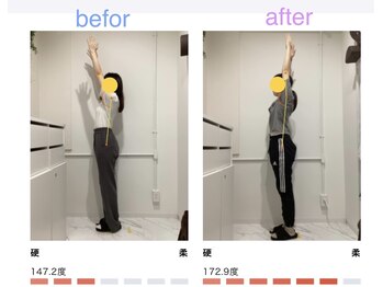 レピア 夙川本店(Lepia)/ビフォーアフターのご紹介♪