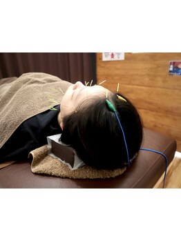 鍼灸施術を受けたい