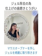 ホワイトニングショップ 三島店(WHITENING SHOP)/【ホワイトニングの流れ】７