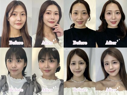 リリィミュール(LilyMule)の写真
