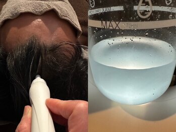 マーブルリング(marblering)の写真/スッキリ爽快☆頭皮のベタつきを抑え炭酸美容液で冷た～いが気持ちいい!やみつき間違いなし!リフトアップ◎